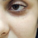 Eyelash-lifting