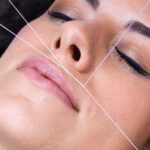 Upper-lip-threading